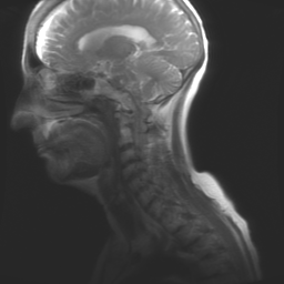 MRI scan of my brain